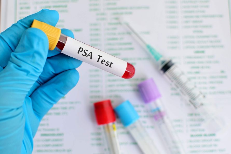 PSA-Test - Prostata-Diagnostik